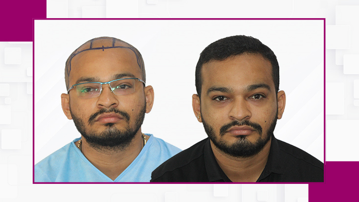 Before-After4