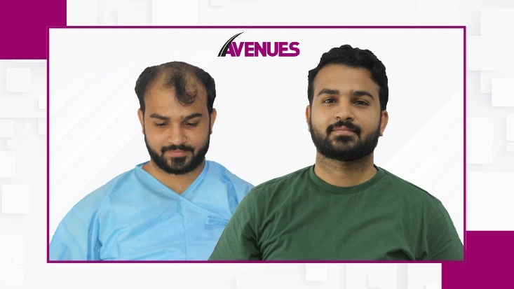 Before-After10