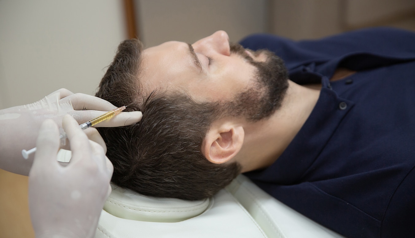 India Leads the Race for Lush Hair with Advanced Hair Transplant Solutions