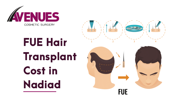 Fue Hair Transplant Cost in Nadiad