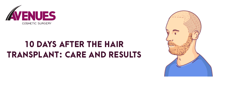 10 Days After Hair Transplant: Care and Results