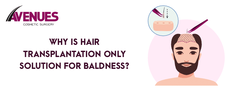 Why Is Hair Transplantation Only Solution for Baldness?