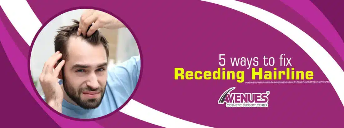 5 Ways To Fix Receding Hairline