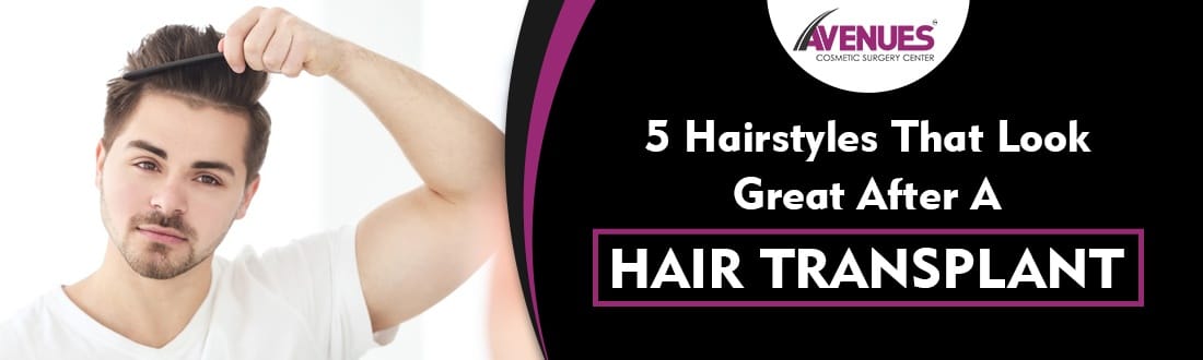 5 Hairstyles That Look Great After a Hair Transplant