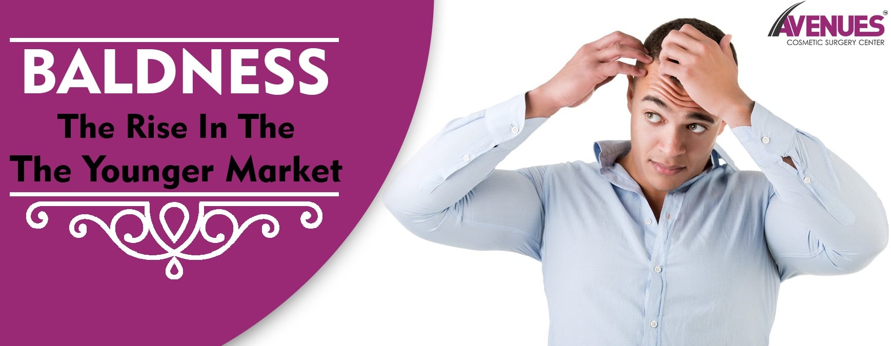 Baldness: The Rise in The Younger Market