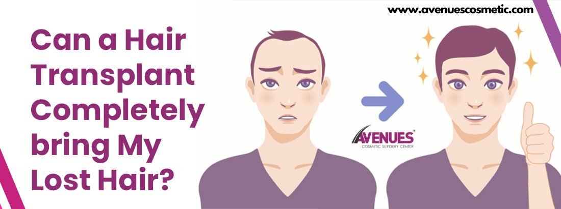 Best Hair Transplant Doctor in India