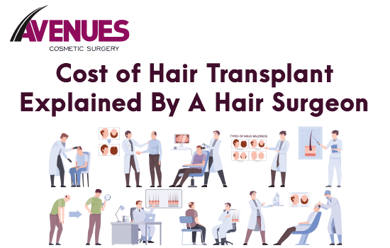 Cost of Hairline Transplant Explained by a Hair Surgeon