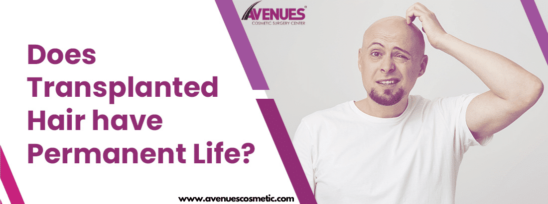 Does Transplanted Hair have Permanent Life?