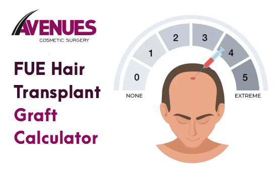 FUE Hair Transplant Graft Calculator