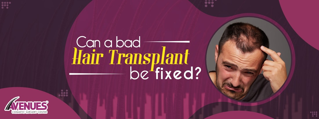 Can A Bad Hair Transplant Be Fixed?