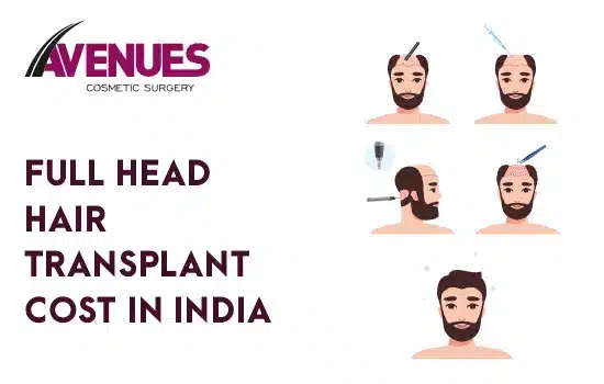 Full Head Hair Transplant Cost in India