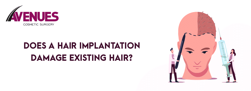 Does a Hair Implantation Damage Existing Hair?