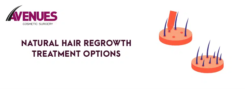 Natural Hair Regrowth Treatment Options: A Comprehensive Guide