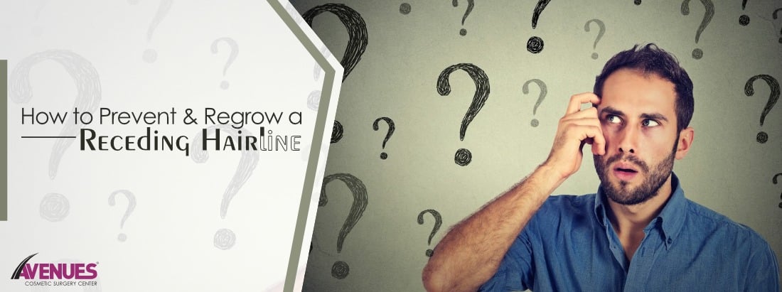 How to Prevent and Regrow a Receding Hairline