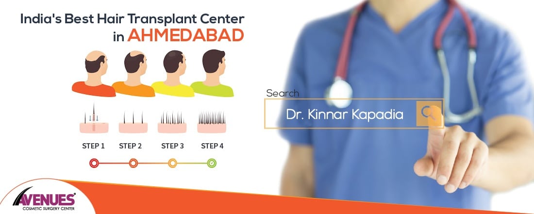 India’s Best Hair Transplant Center in Ahmedabad