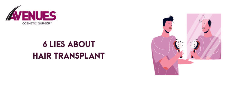 6 Lies About Hair Transplant