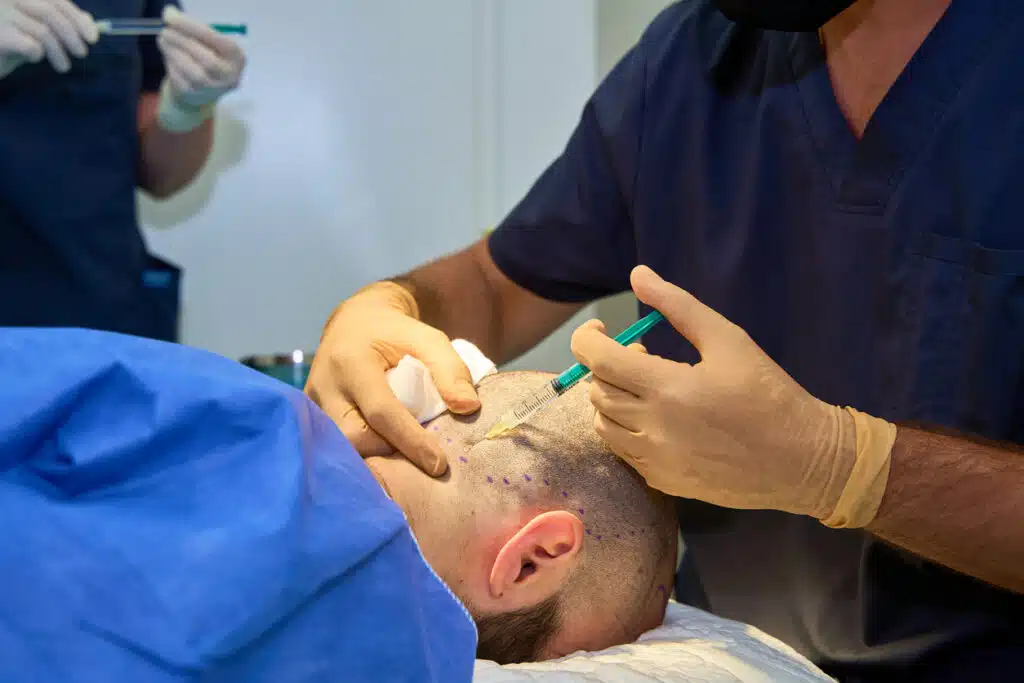 Comparing Hair Transplant Clinics: India vs. Turkey