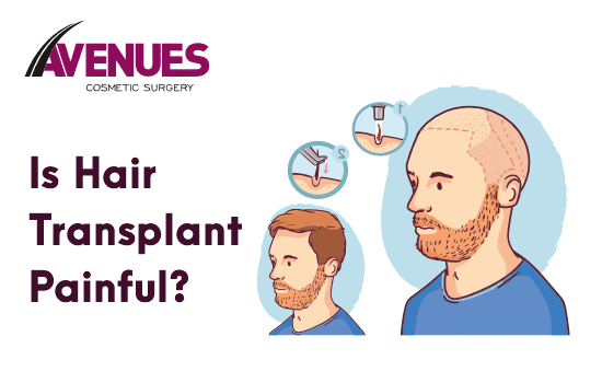 Is Hair Transplant Painful?