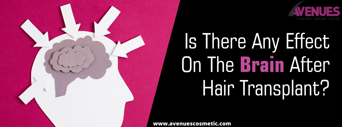 Is There Any Effect on The Brain After Hair Transplant in Gujarat?