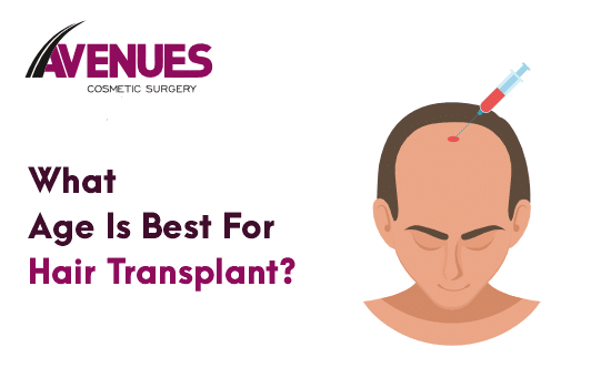 What Is the Best Age for a Hair Transplant?
