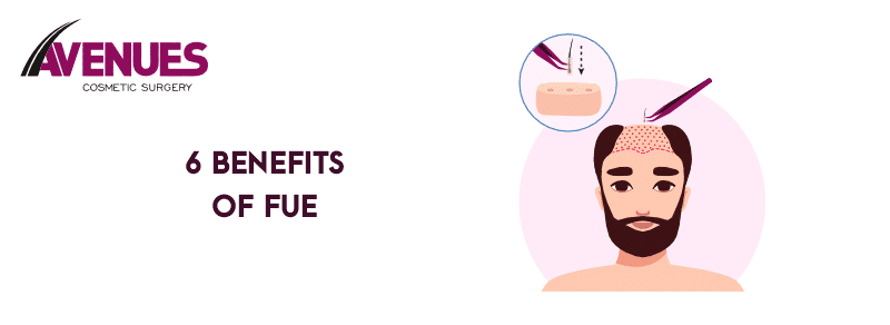 6 Benefits of FUE