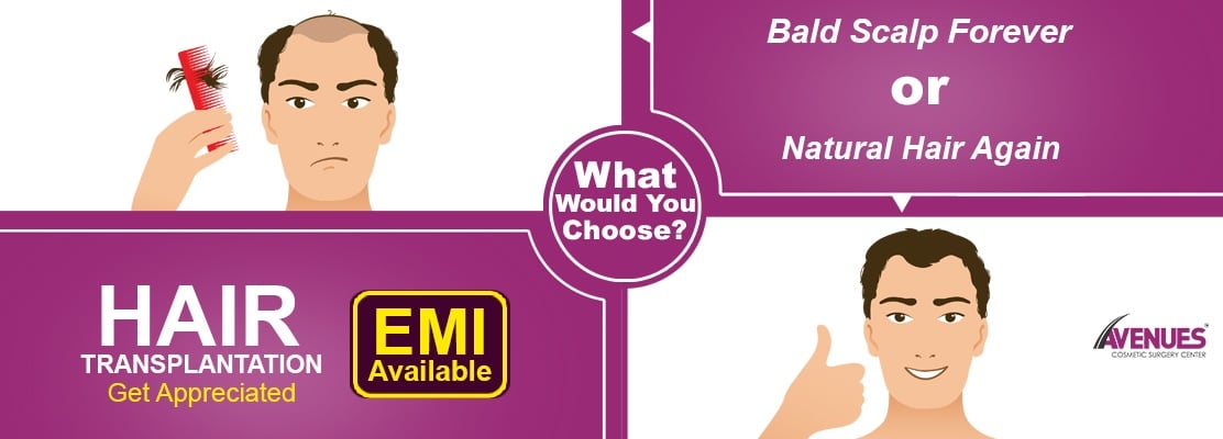 What Would You Choose? Bald Scalp Forever or Natural Hair Again