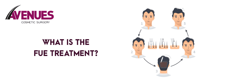 What Is the Fue Treatment?