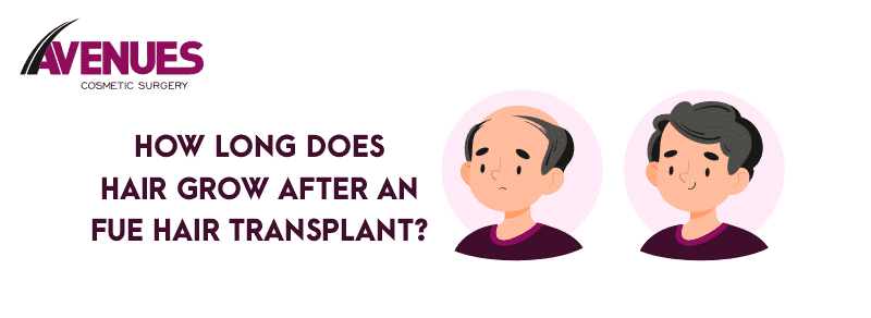 How Long Does Hair Grow After FUE Hair Transplant?