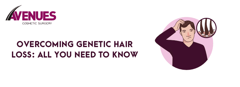Overcoming Genetic Hair Loss: All You Need to Know