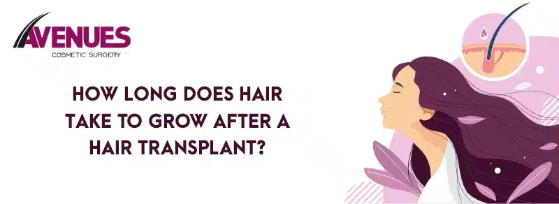 How Long Does Hair Take to Grow After a Hair Transplant?