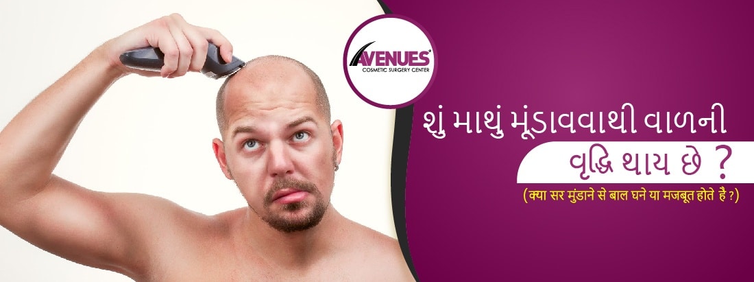 શું માથું મૂંડાવવાથી વાળની વૃદ્ધિ થાય છે ?