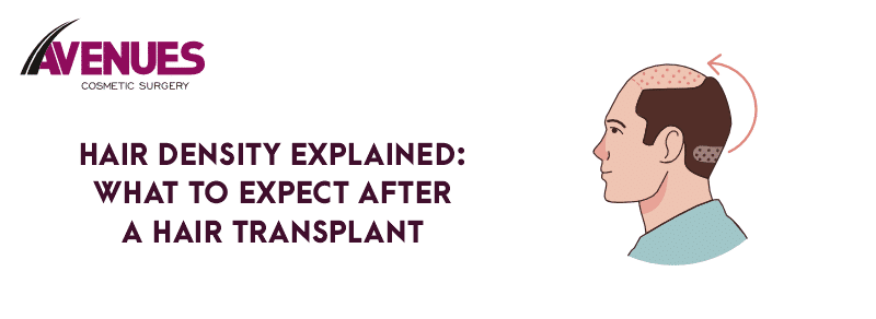Hair Density Explained: What to Expect After a Hair Transplant