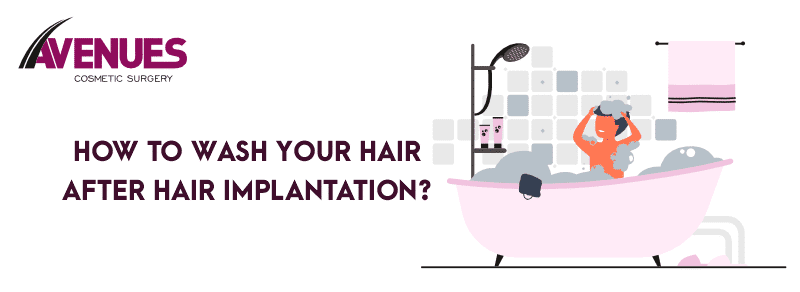How to Wash Your Hair After Hair Implantation?
