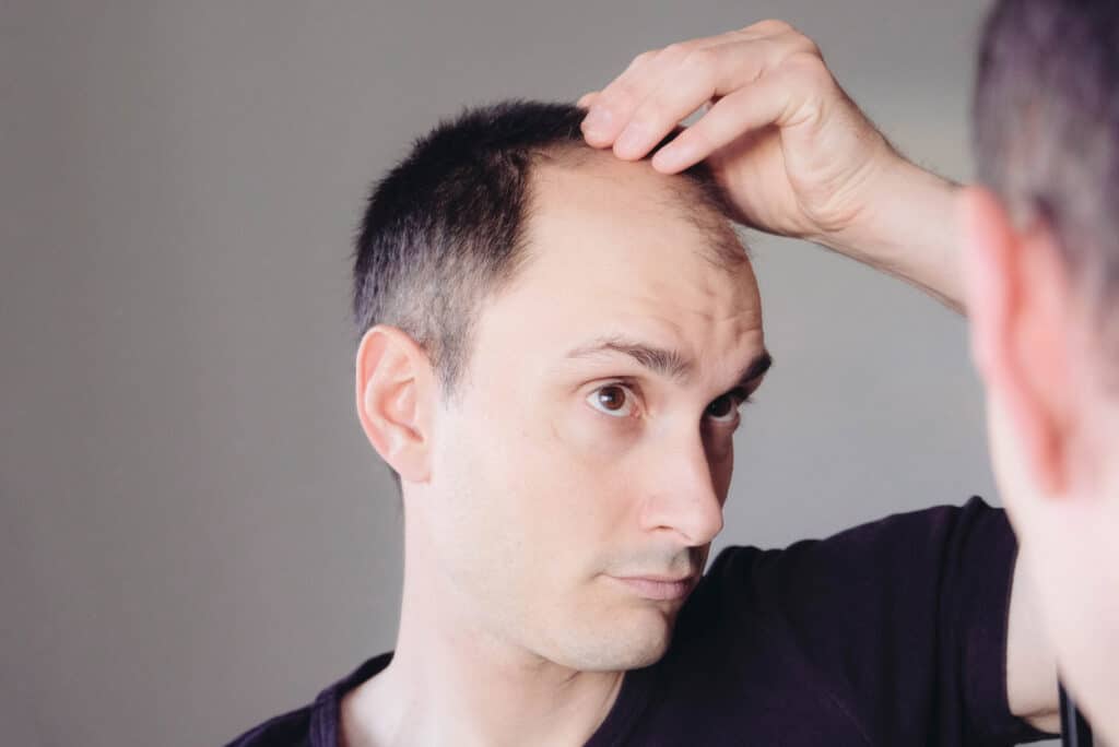 How to Choose the Best Hair Transplant Clinic: A Guide