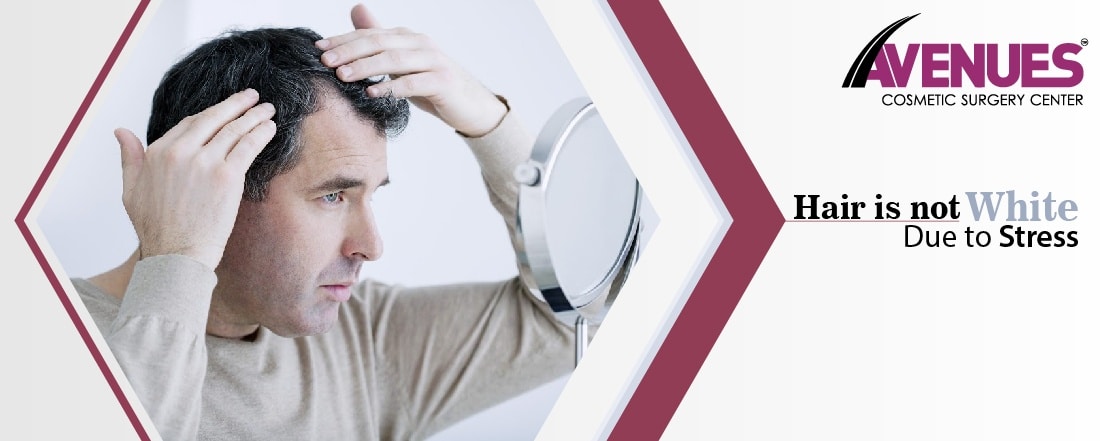 Hair is not white due to stress