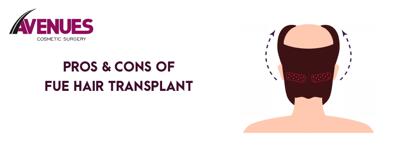 Pros & Cons of Fue Hair Transplant