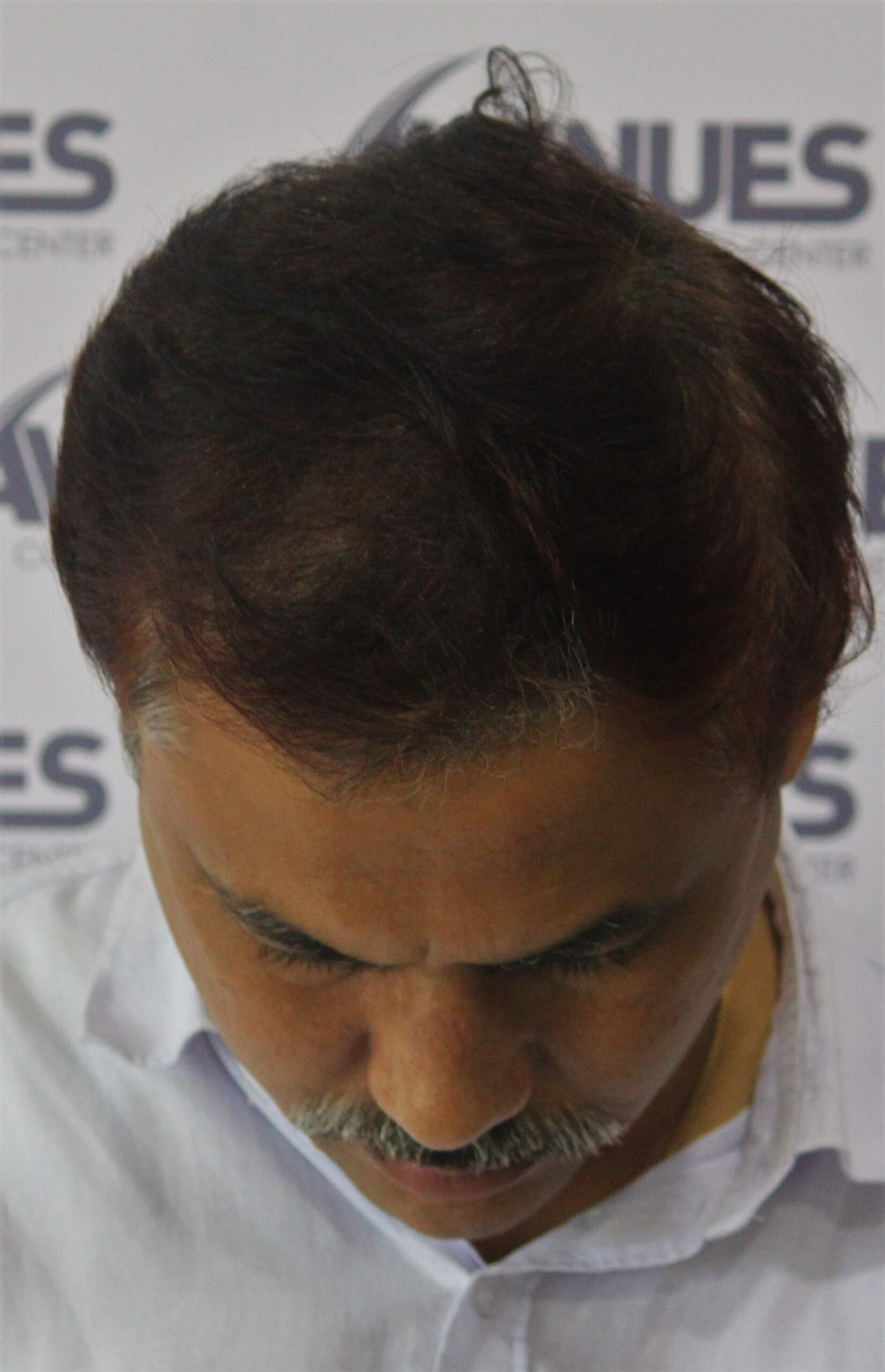 Copy of 6