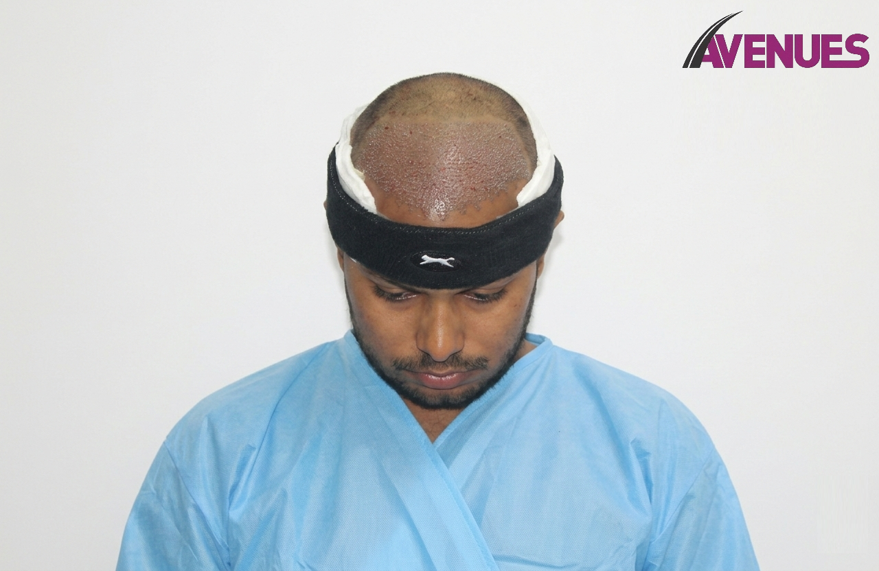 Front Head Down - Post-op