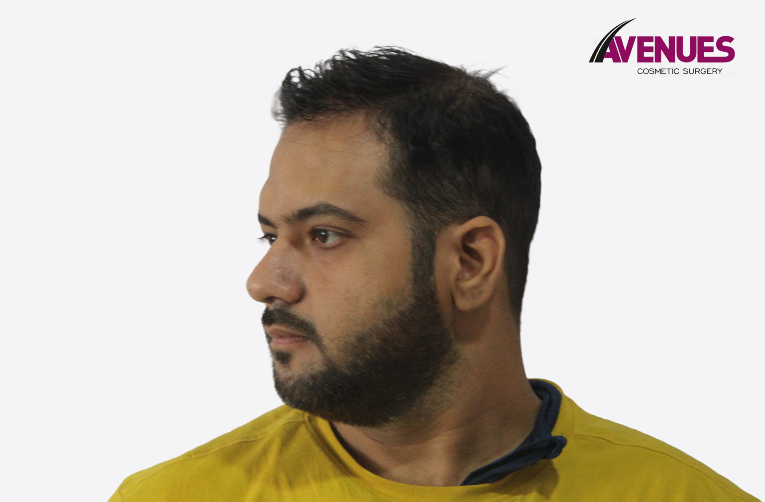 farzan memon-8