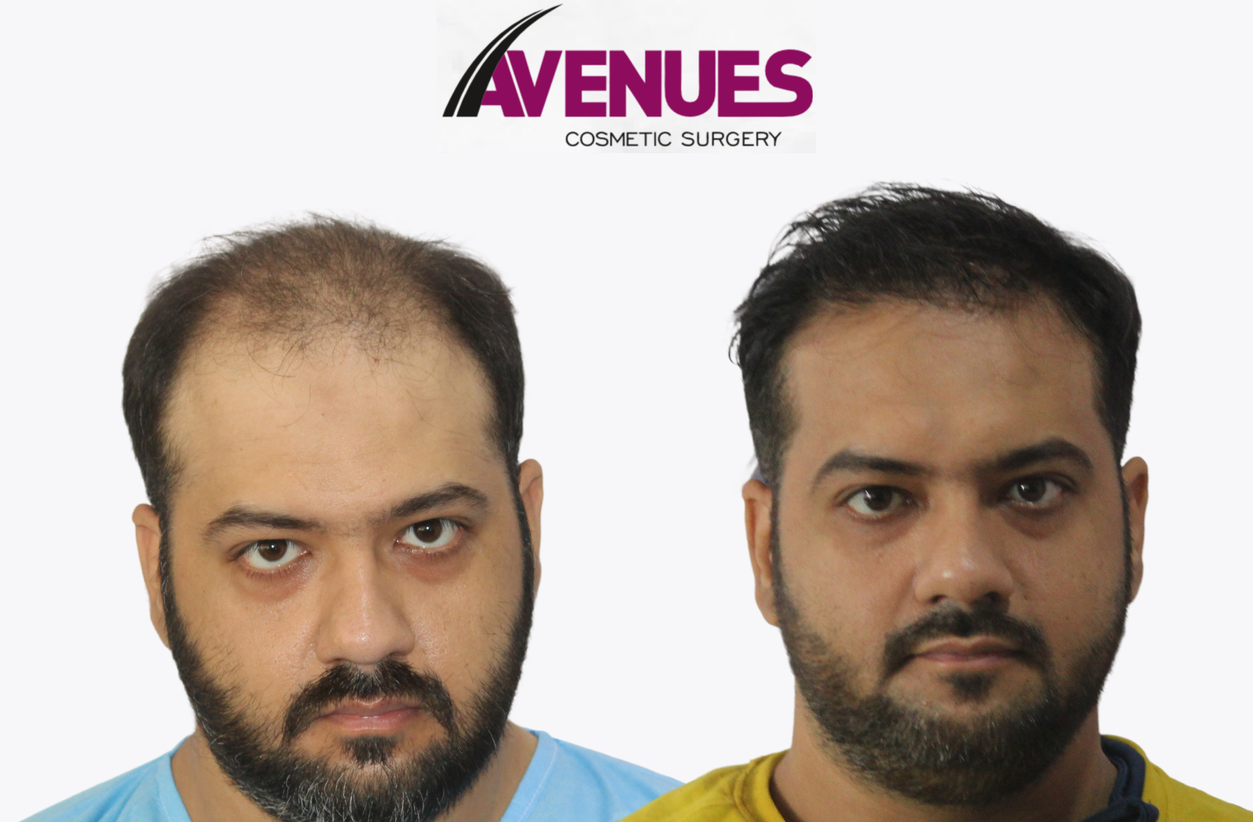 farzan memon-before after