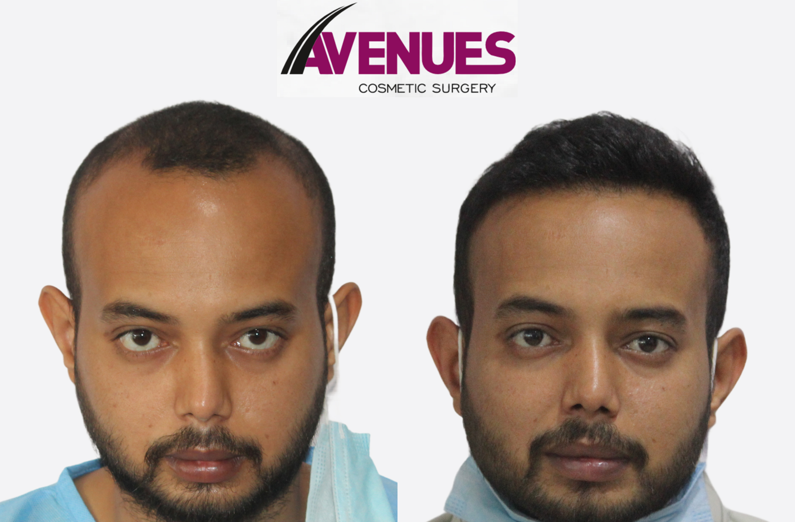 pratik lohiya-before after