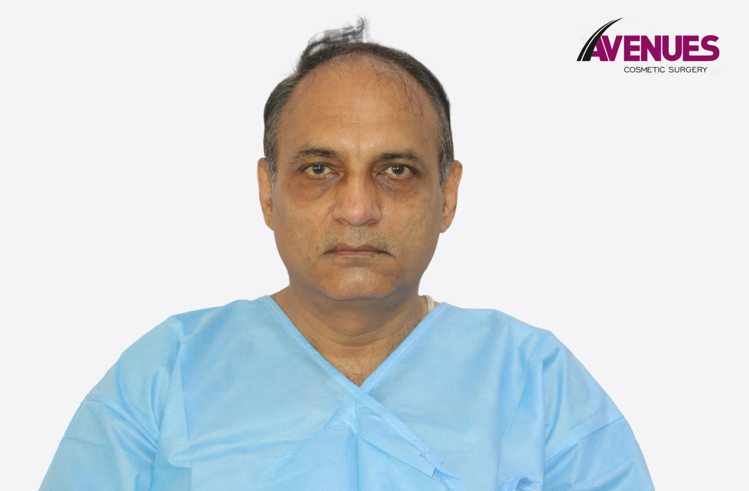 sunil raval-1