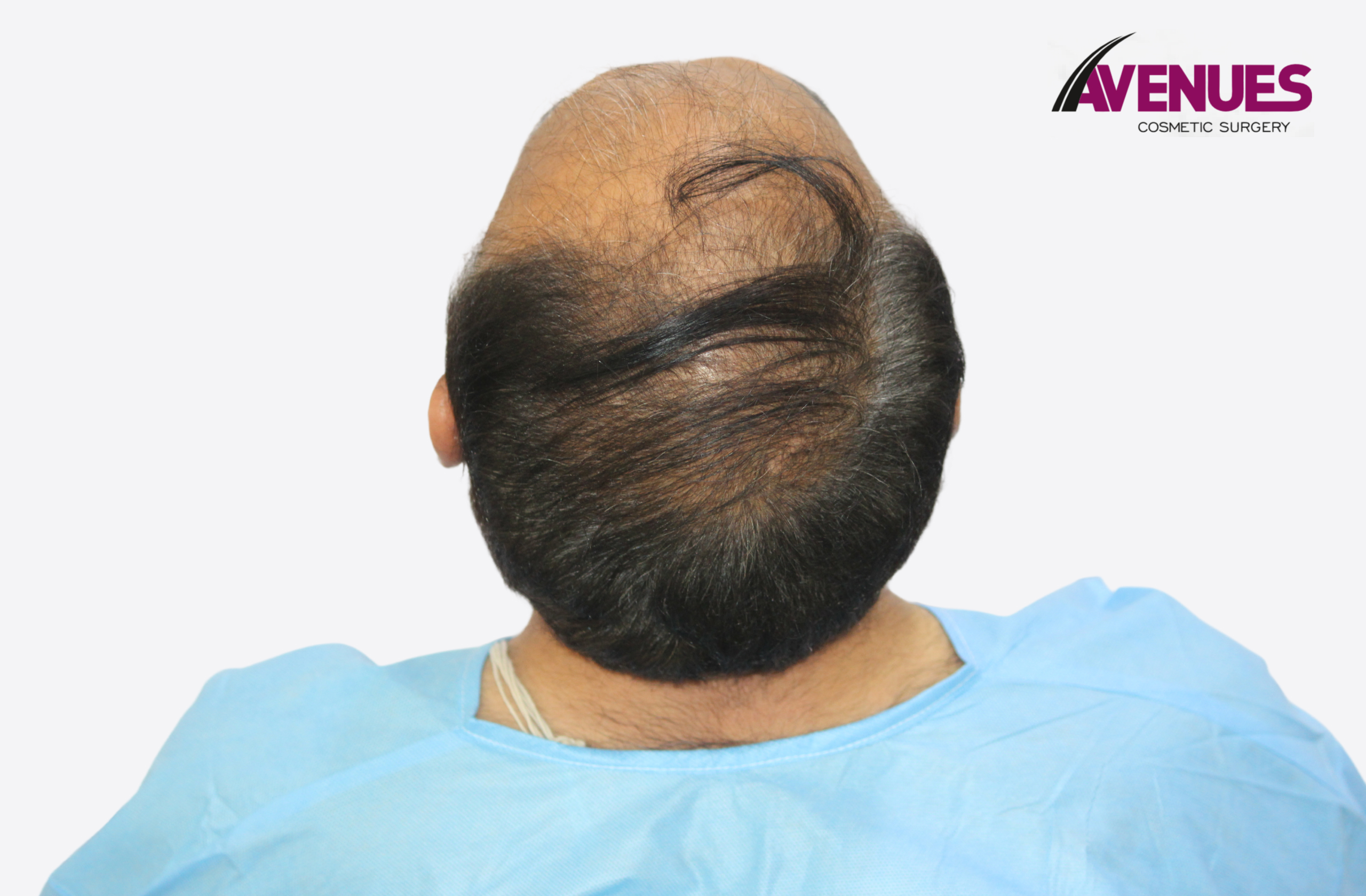 sunil raval-11