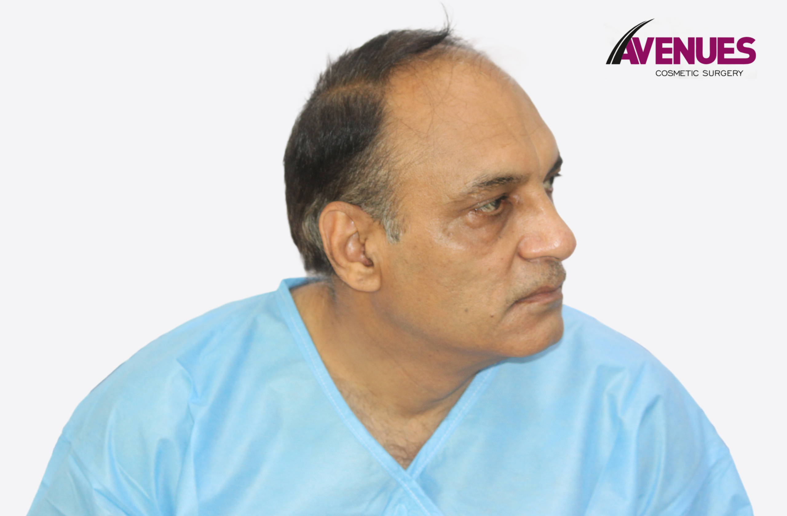 sunil raval-7