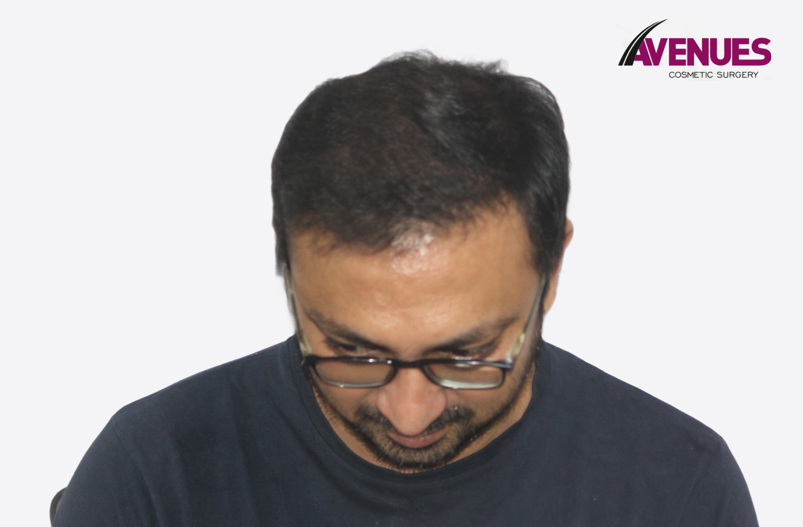 yatish pathak-10
