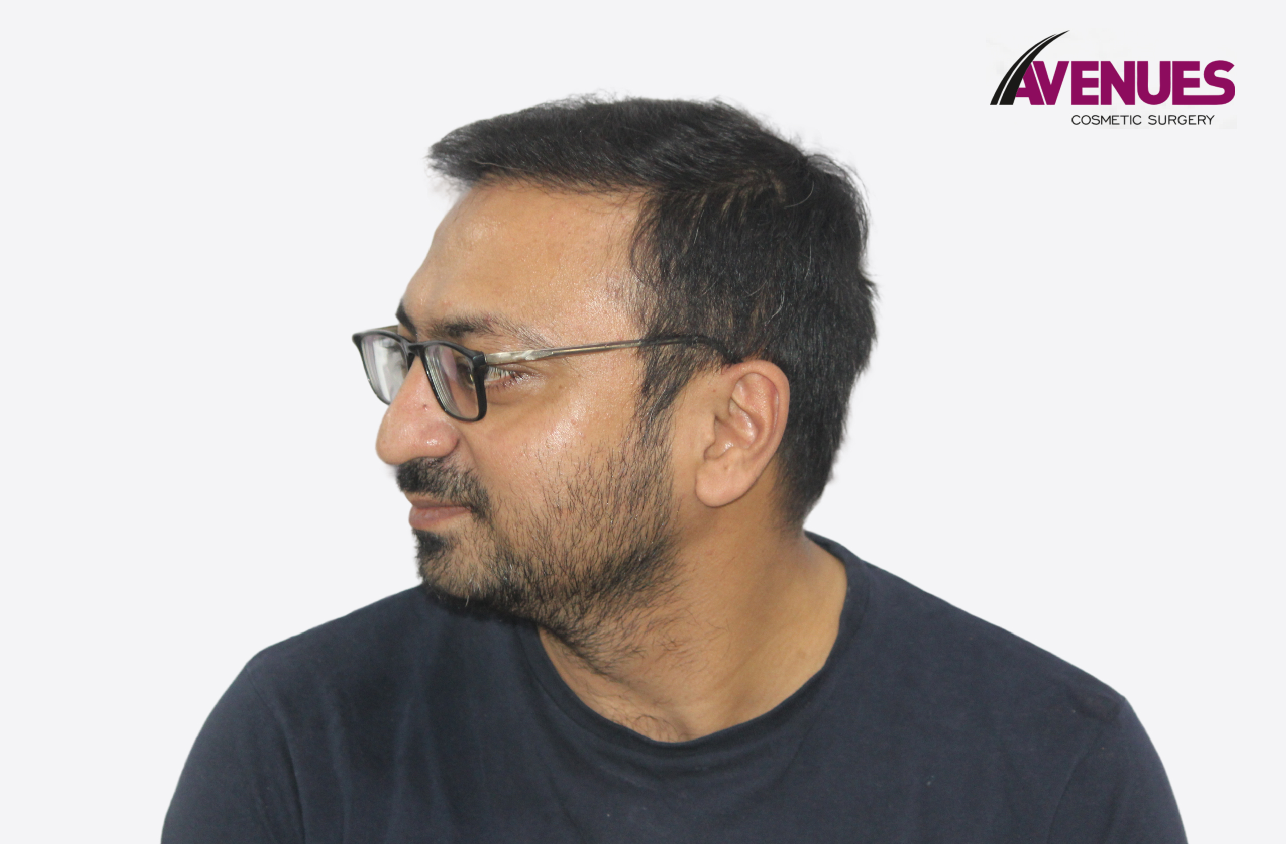 yatish pathak-11