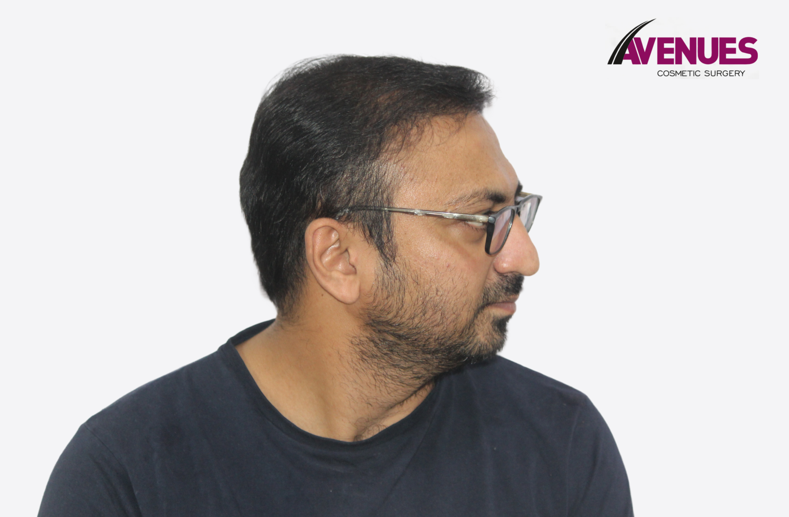 yatish pathak-12