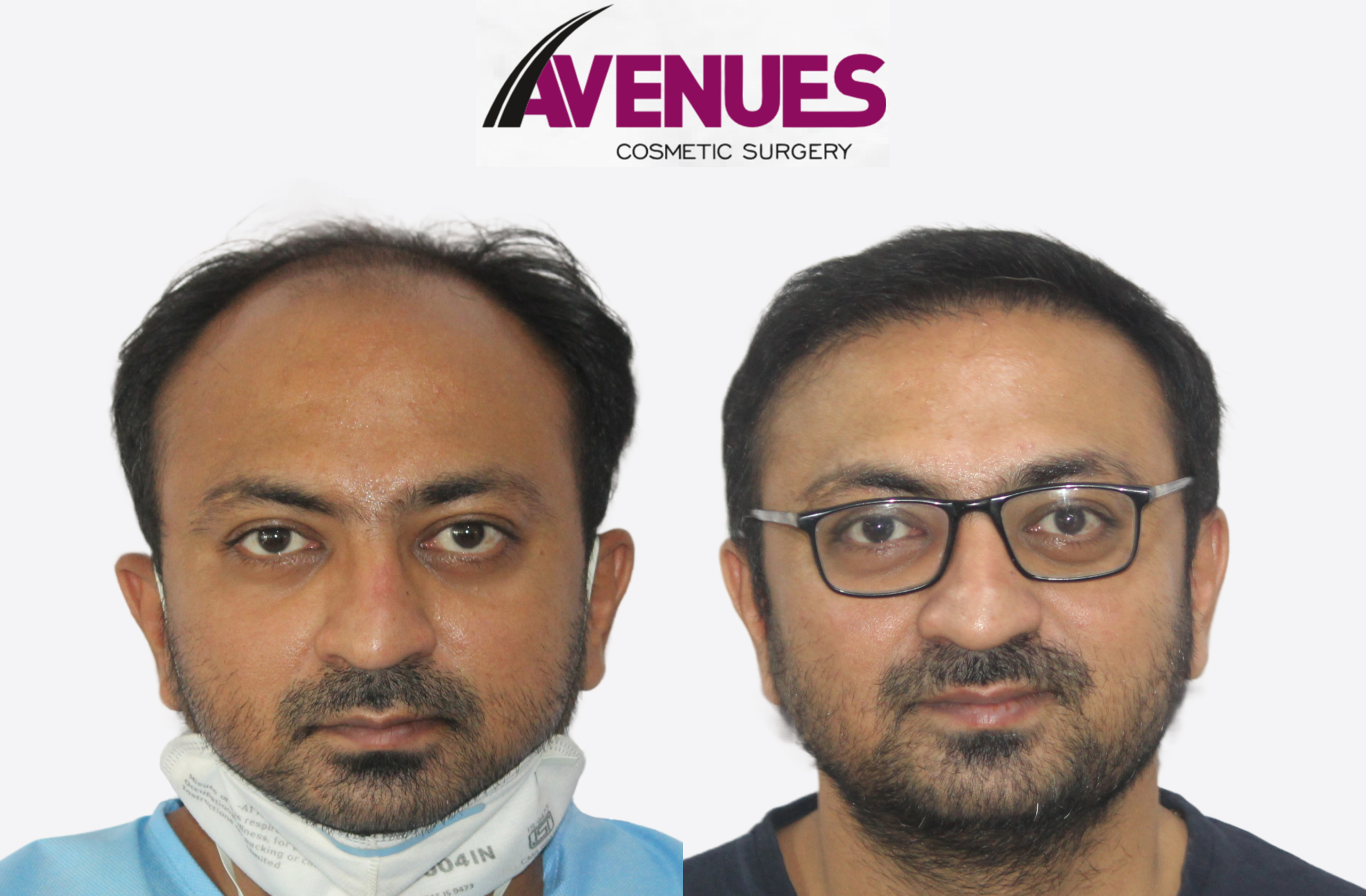yatish pathak-before after