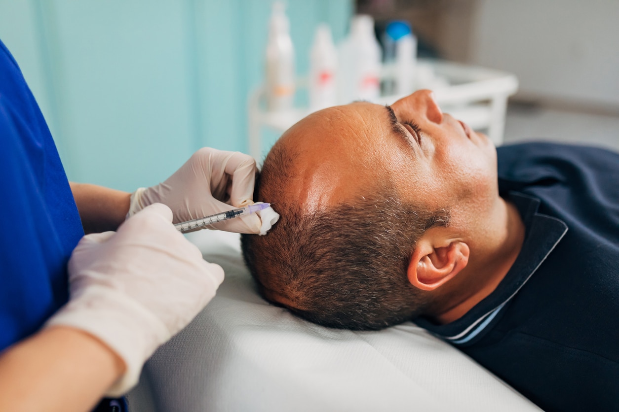 In our ordination we have vitamins shoots which will fasten the growth of your hair line, so visit us