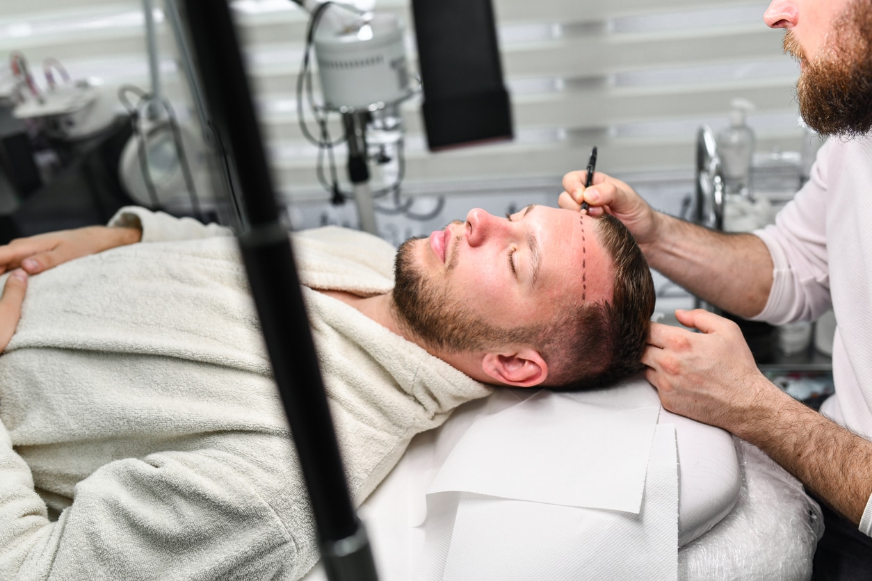 AI & Robotic Hair Transplants: Real Innovation or Just Marketing Hype?